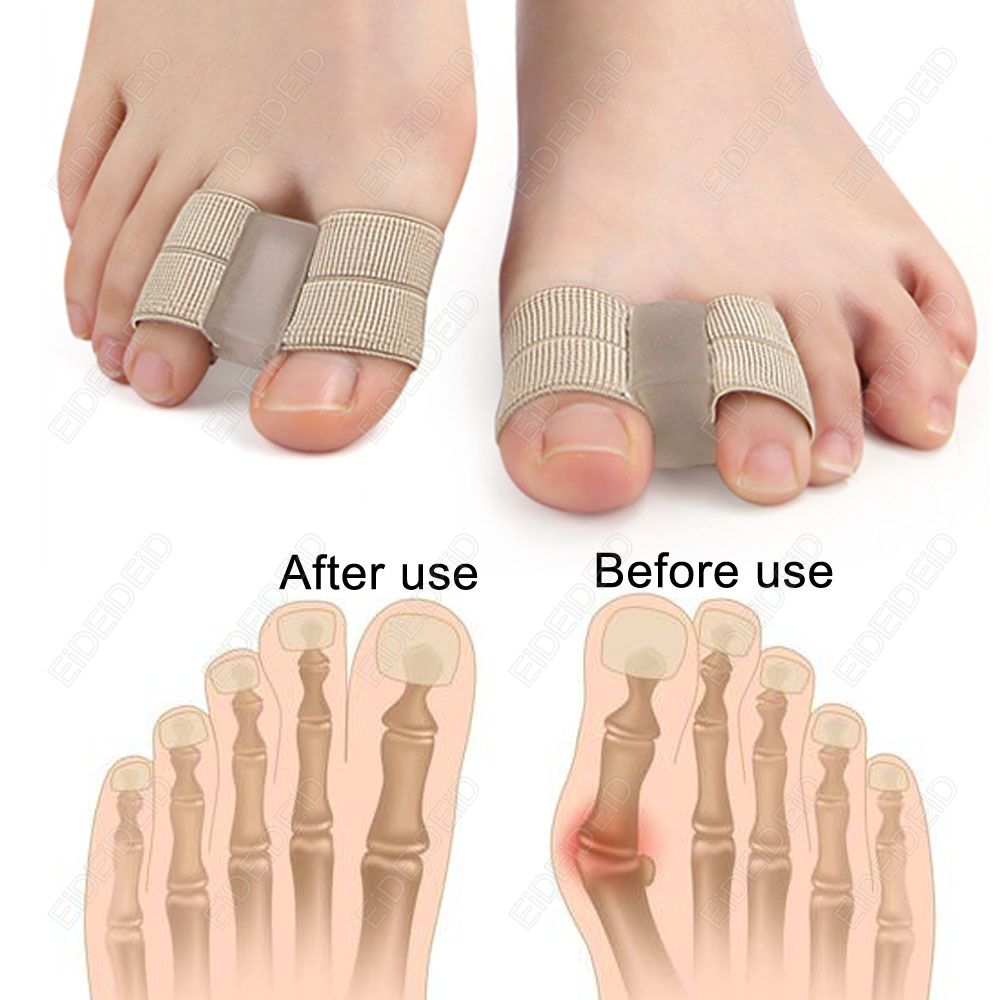 Bunion toe Corrector Orthotics - Women'S Shoes With Bunions 리뷰 및 가격